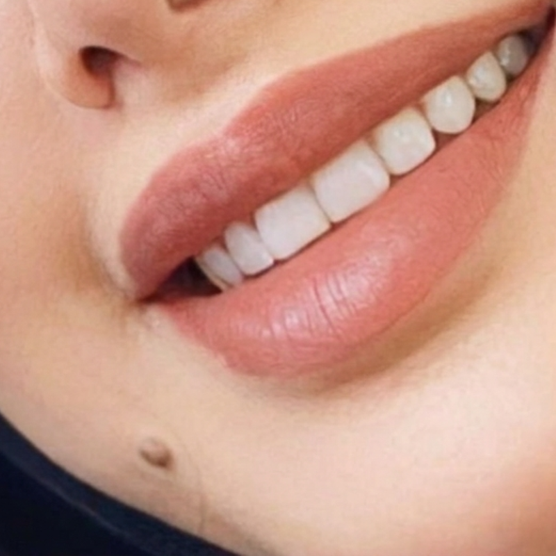Teeth Care