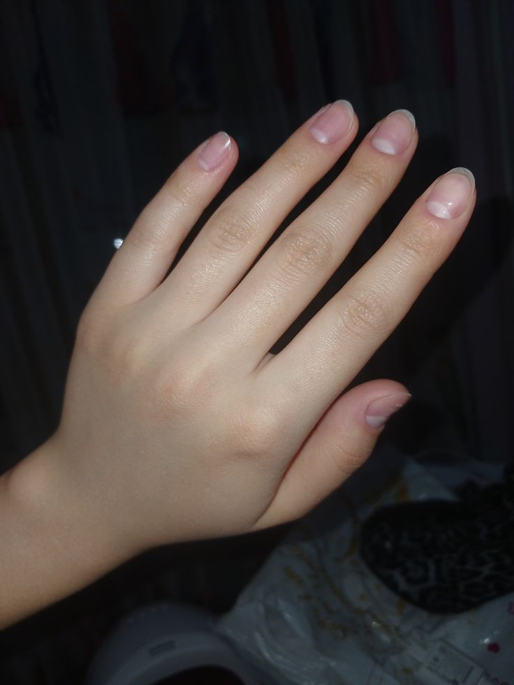After