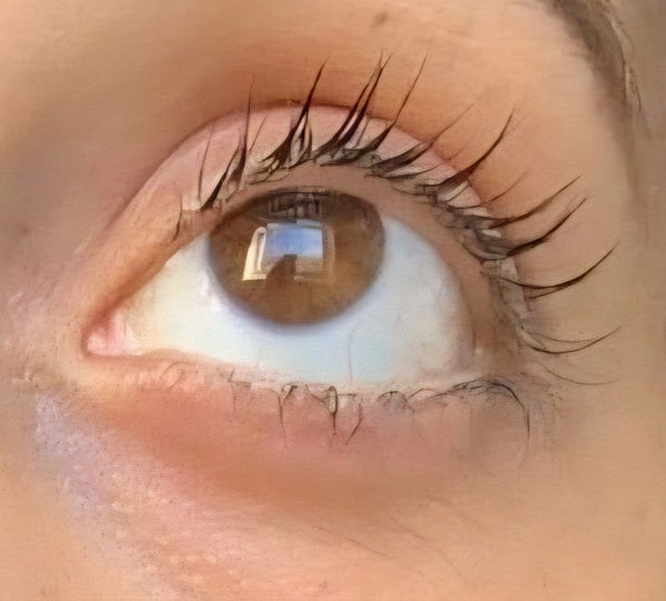 Before - Sally