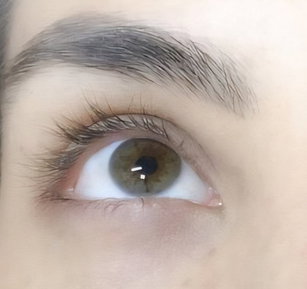 Before - Rola