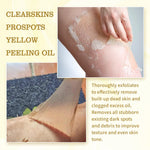Yellow Peeling Oil Bleaching Brightening Dark Spots Body Knees Exfoliating Remove Dead Skin Lightening