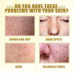 Yellow Peeling Oil Bleaching Brightening Dark Spots Body Knees Exfoliating Remove Dead Skin Lightening