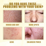 Yellow Peeling Oil Bleaching Brightening Dark Spots Body Knees Exfoliating Remove Dead Skin Lightening