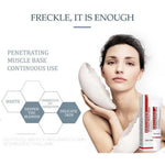 Whitening Niacinamide Cream Brightens, Moisturizes, Reduces Freckles & Dark Spots